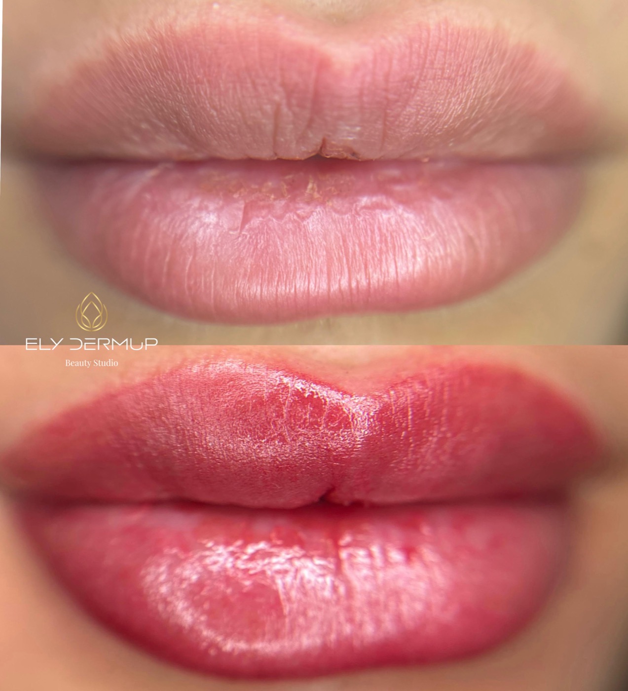 Trucco permanente labbra dal risultato naturale